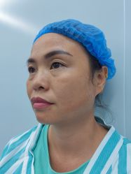 -天津健丽·去眼袋医疗美容机构