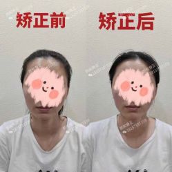 -颜和骨正·明哲式骨相美学整骨