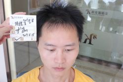 点击看大图 -大麦微针植发丨全国连锁