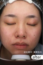 -Yestar宁波艺星整形医院