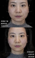 -Yestar重庆艺星医疗美容医院