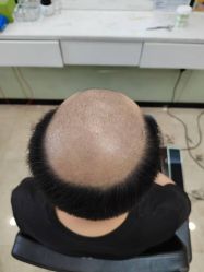 -唐风采假发补发定制
