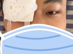 -昆明爱尔眼科医院