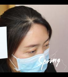 点击看大图 -大麦微针植发全国连锁