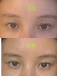 -上海时光整形外科医院
