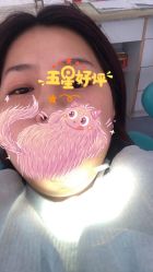 体验前-JUVA郑州欧华医疗美容医院