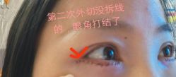 -上海时光整形外科医院