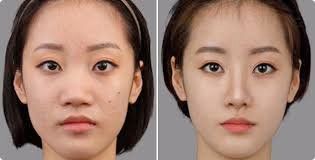 -SKINIST丽铂医疗美容