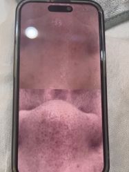 -SKIN79皮肤管理中心