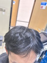 -雍禾植发