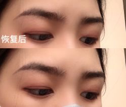 -OnFaer.纹眉半永久无创洗眉