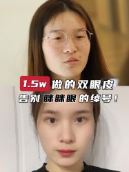 -上海时光整形外科医院