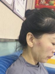 -北京美痣堂古方祛痣斑疣瘊