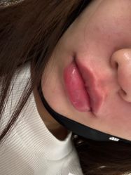 -海涛医疗美容·面部抗衰·注射美鼻