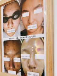 -美肤盾祛痘·问题肌头疗管理中心