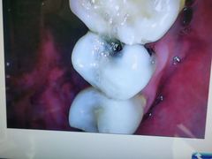 -深圳乐孚正强口腔诊所(宝体店)