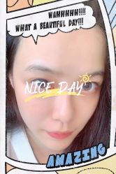 点击看大图 体验后-大麦微针植发全国连锁