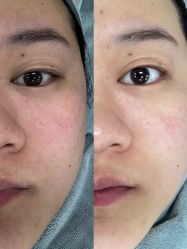 点击看大图 -SKIN79皮肤管理中心