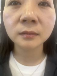 -长沙雅美医疗美容医院