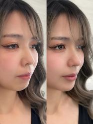 点击看大图 -上海伊莱美医疗美容医院