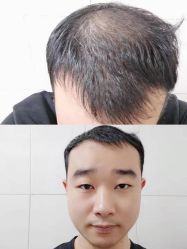 -雍禾植发全国连锁