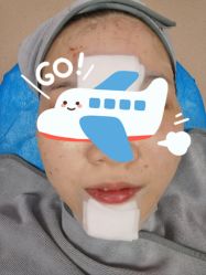 体验后-圣嘉新医疗美容医院