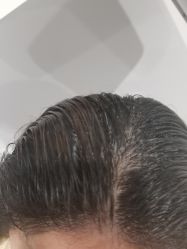 -熙朵美学植发·连锁品牌