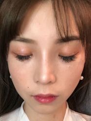-深圳艺星医疗美容医院