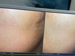 -苑苑vbeauty科技美容SPA