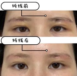 -圣嘉新医疗美容医院