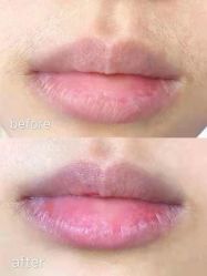 -慈蕊美容养生·专业经络调理