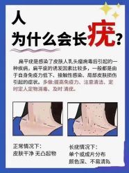 -瑶芳清颜草本祛痘