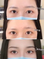 -久匠半永久纹眉