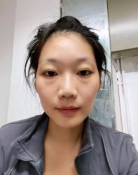 体验前-深圳美莱医疗美容医院