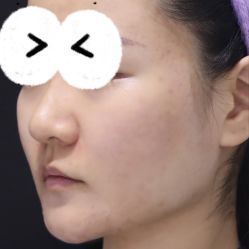 体验后-和颜一美轻医美连锁