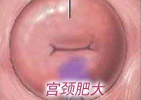 -邢台妇产医院
