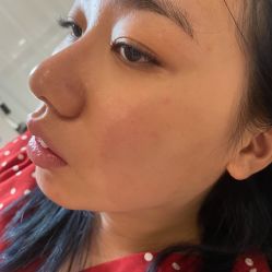 -JNK皮肤管理中心