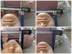 -颜和骨正·明哲式骨相美学整骨
