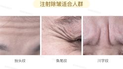 -北京米扬丽格医疗美容·联合丽格鼻整形中心