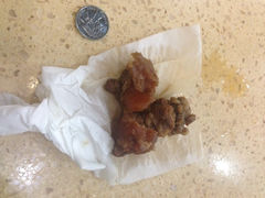 iphone_upload_pic-群姐面馆·海鲜烧烤(同安路二店)