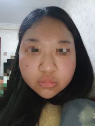 体验后-原力医疗美容