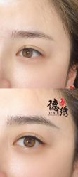 -德绣·机器野生眉发际线·美瞳线半永久