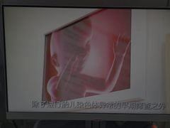 -济南艾玛体检中心