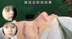 -Yestar重庆艺星医疗美容医院