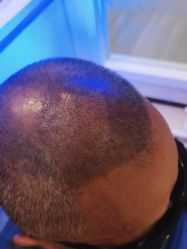 -雍禾植发全国连锁