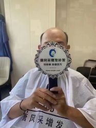 -唐风采假发补发定制