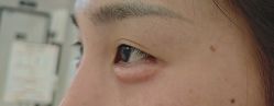 -Yestar 嘉兴艺星医疗美容医院