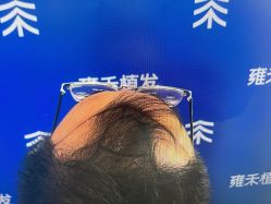 -雍禾植发全国连锁