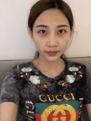 -美莱医学美容医院