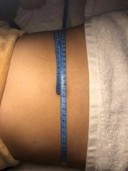 -肥三针腧穴瘦身馆